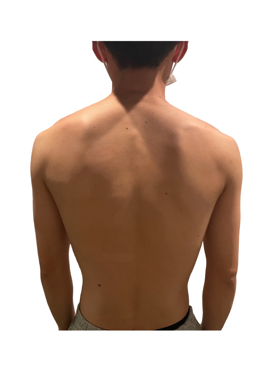20代男性 ビフォー