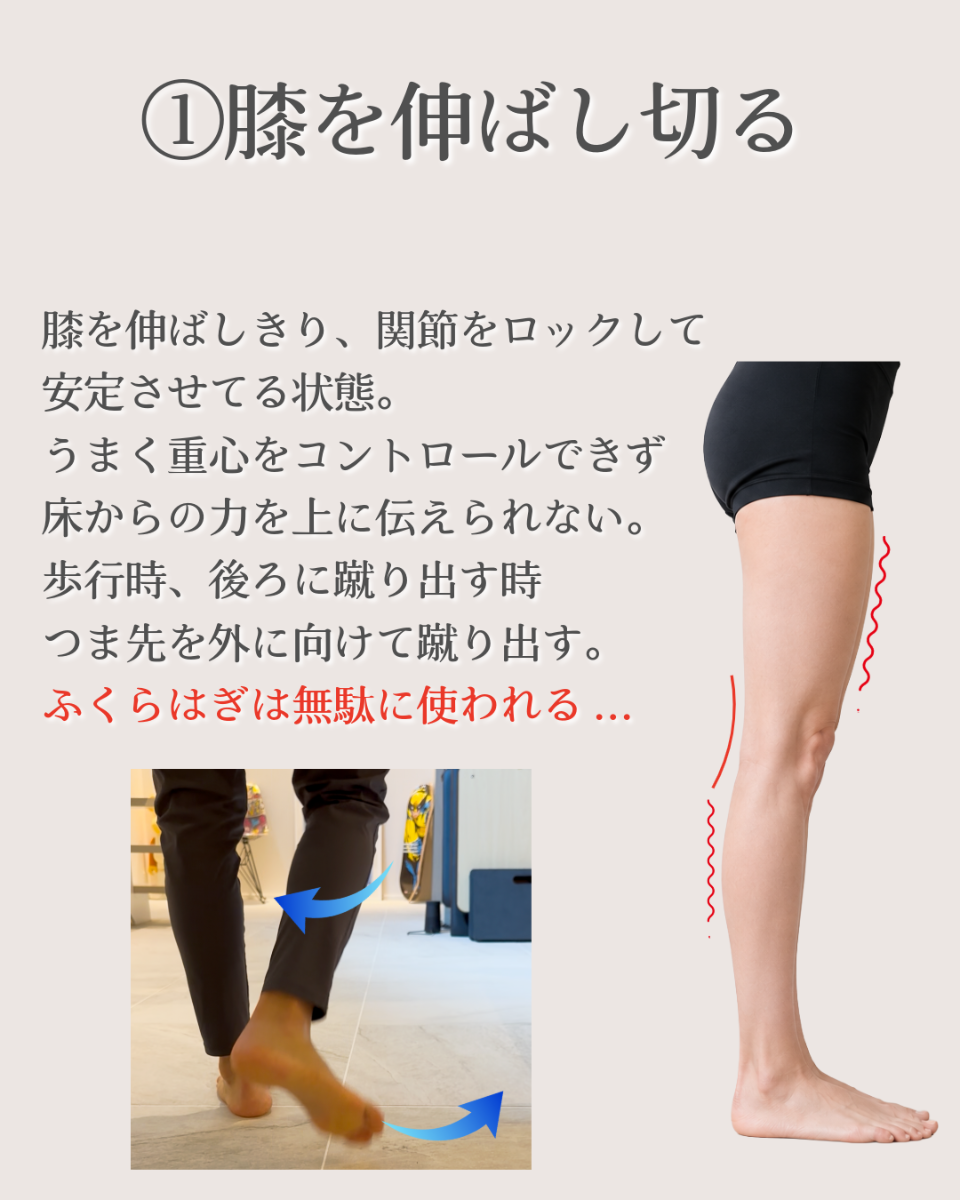 膝を伸ばし切って立つ反張膝と、歩行時に足先が外へ流れる動きを示した画像。膝をロックした姿勢によって、ふくらはぎに負担がかかりやすくなる状態を解説しています。