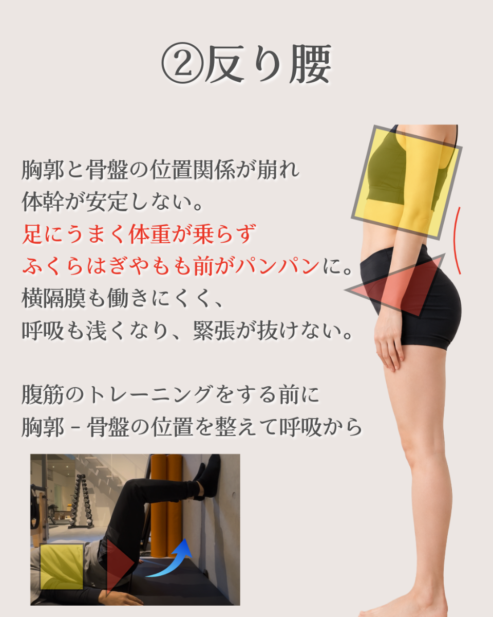 胸郭と骨盤の位置関係が崩れた反り腰姿勢を横から示した画像。体幹が安定しにくく、前ももやふくらはぎに負担がかかりやすい状態と、姿勢・呼吸を整えるエクササイズを解説しています。