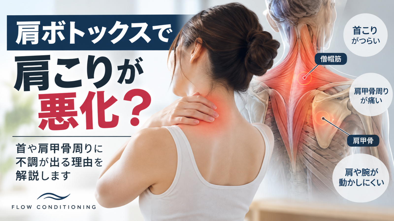 肩ボトックス後の首こりや肩甲骨周りの不調について、僧帽筋と肩甲骨の関係を解説するイメージ